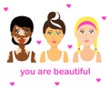Various pretty girls with vitiligo. Cartoon. Vector.